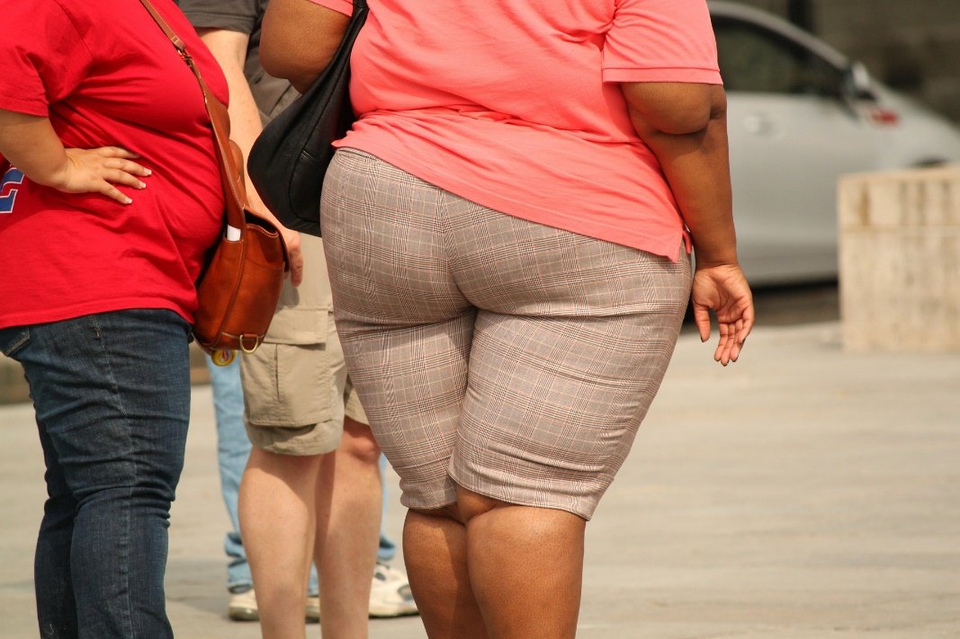 Obesidad homogénea